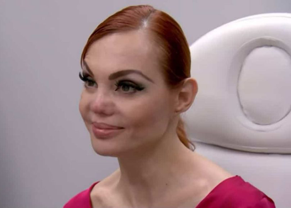 El reality show "Botched", transmitido a través de E! Entertainment, compartió el adelanto de su próximo capítulo donde participará la actriz mexicana, Carmen Campuzano.