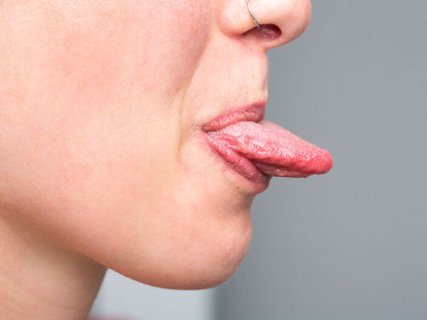 Estas enfermedades puedes identificar con el aspecto de tu lengua