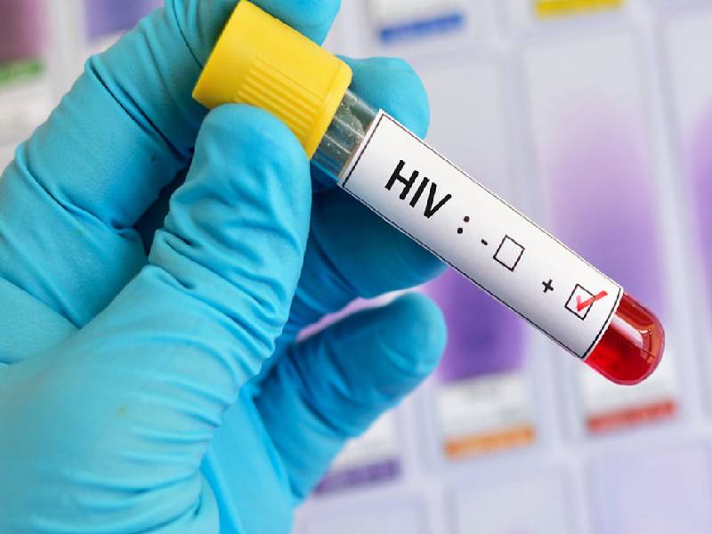 Registra Quintana Roo más de 7 mil casos de VIH