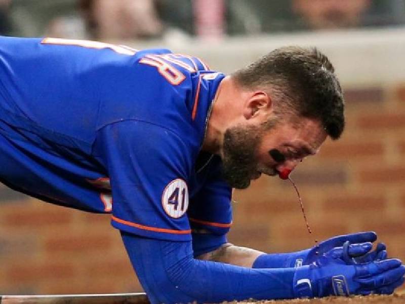 VIDEO. El terrible pelotazo a Kevin Pillar a 152 kilómetros por hora