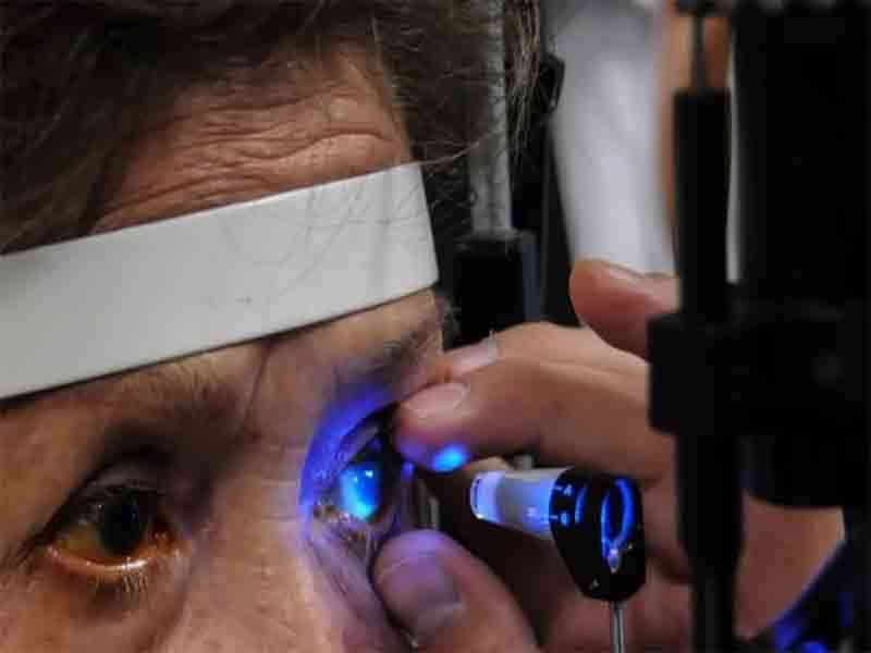 Glaucoma, primera causa de ceguera a nivel mundial