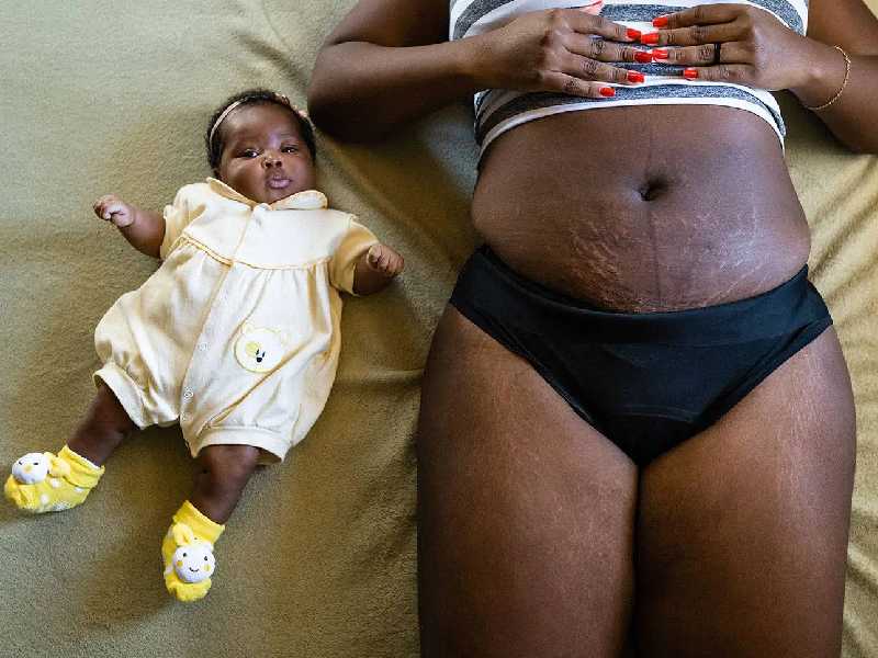 Fotos: La vida real (sin filtros) de mujeres después del parto