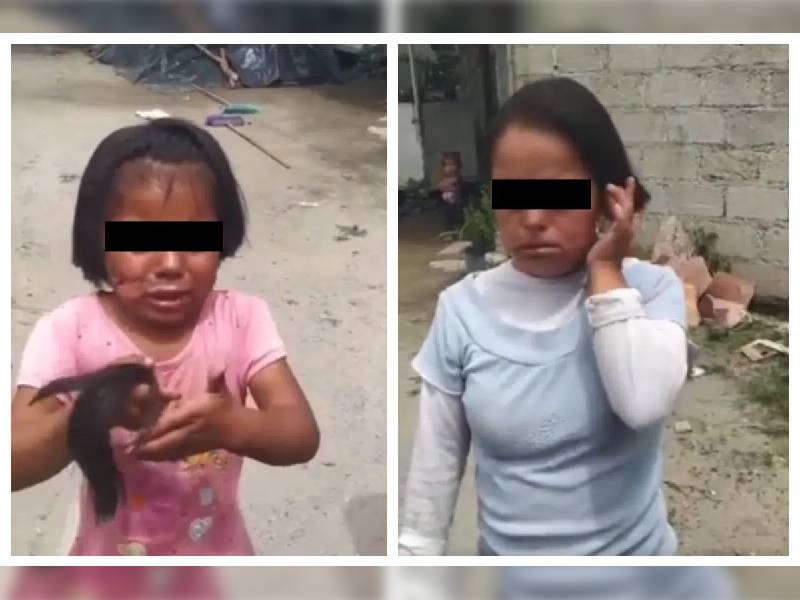 Video. Abuela quema el rostro de su nieta e hija con Down