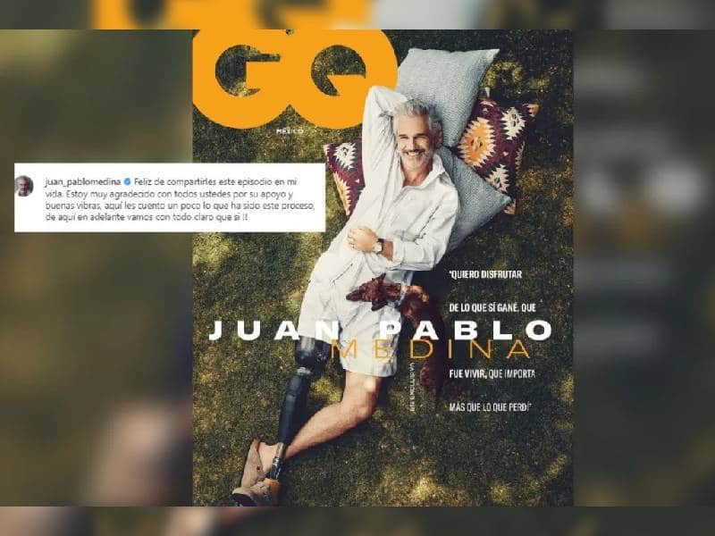 Juan Pablo Medina reaparece en portada de GQ con su nueva prótesis