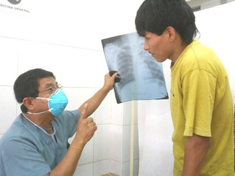Suman 4 casos de tuberculosis entre habitantes de zona maya