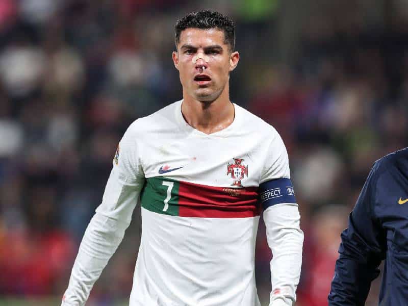 Cristiano Ronaldo sufre fuerte choque durante partido de Portugal