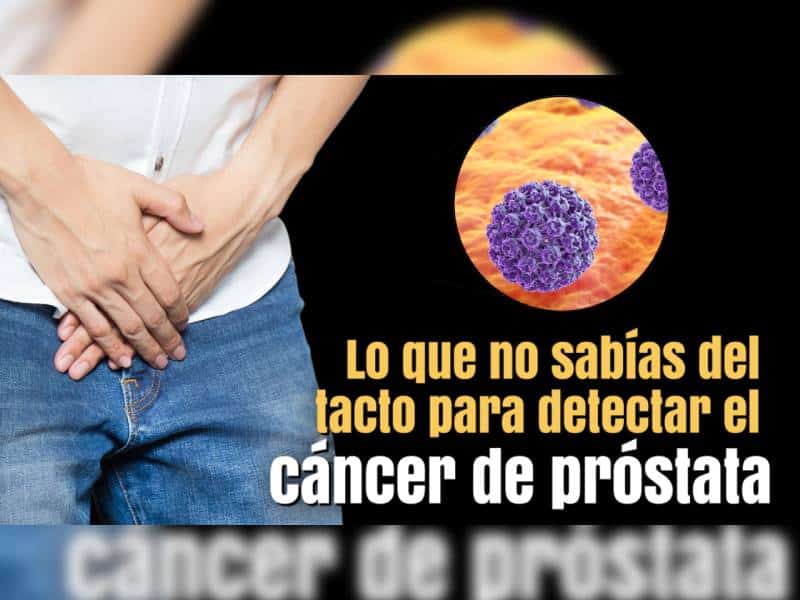 Lo que no sabia del tacto para detectar cancer de prostata