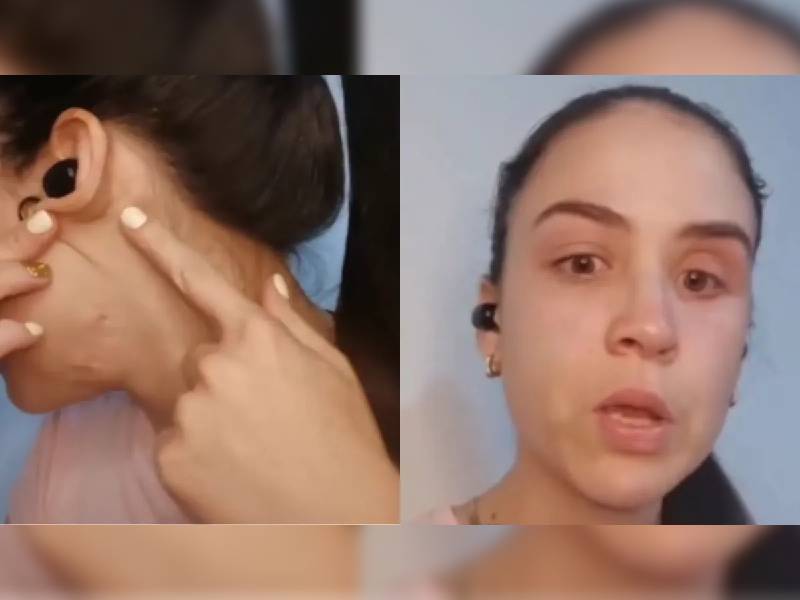 VIDEO: “Me dispararon en la cara”: Mujer cuenta cómo sobrevivió a un secuestro