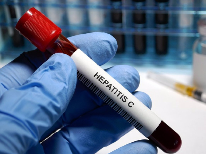 Harán pruebas para detectar hepatitis C
