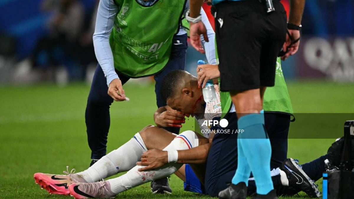 Kylian Mbappé resultó lesionado ayer.