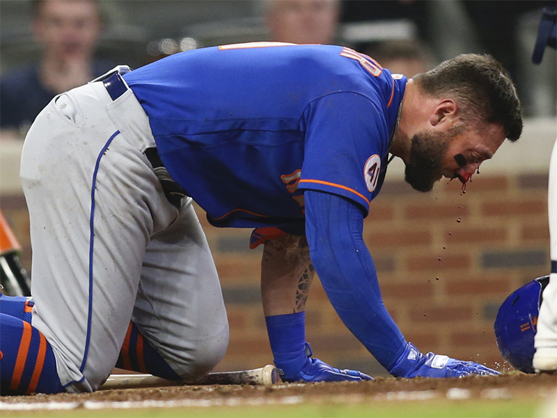 Kevin Pillar recibe un pelotazo brutal en la cara (VIDEO)