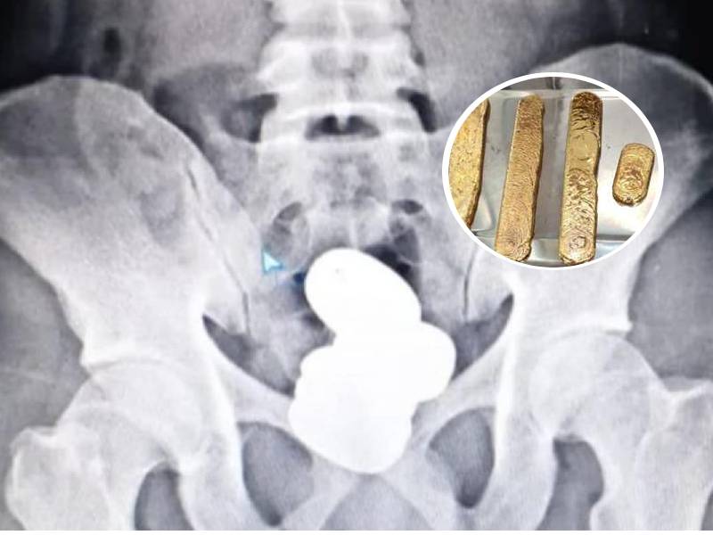 contrabando un kilo de oro