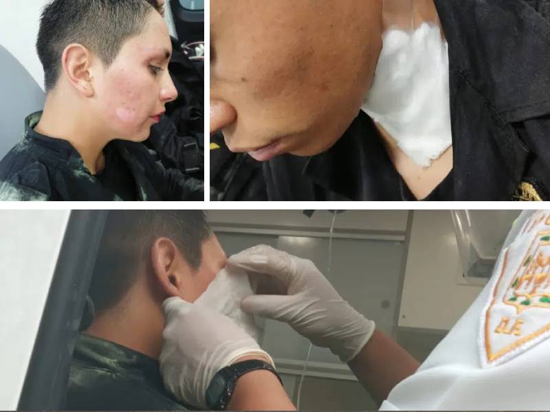 Deja marcha del 2 de octubre lesiones a 5 policías