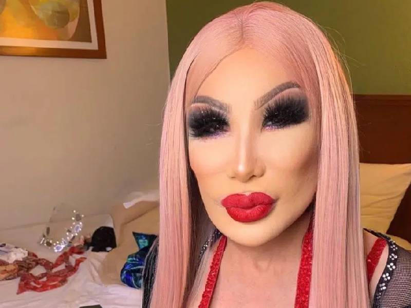 Lyn May recomienda el uso del botox con su nuevo rostro