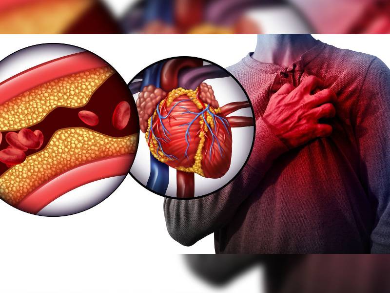 ¿Colesterol alto? una afección silenciosa y peligrosa pero prevenible