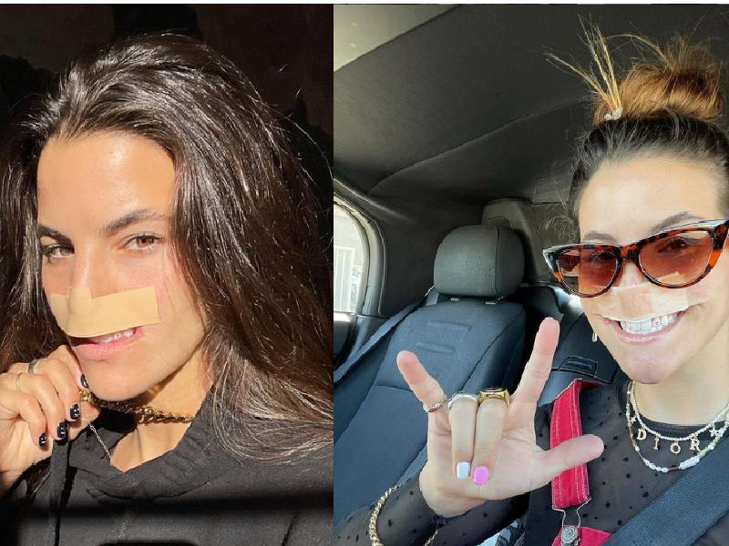 Modelo pierde su labio