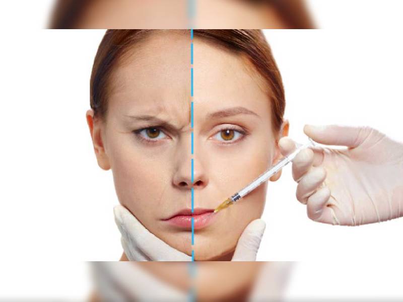 Botox podría ser la solución para reducir niveles de ansiedad, afirman científicos