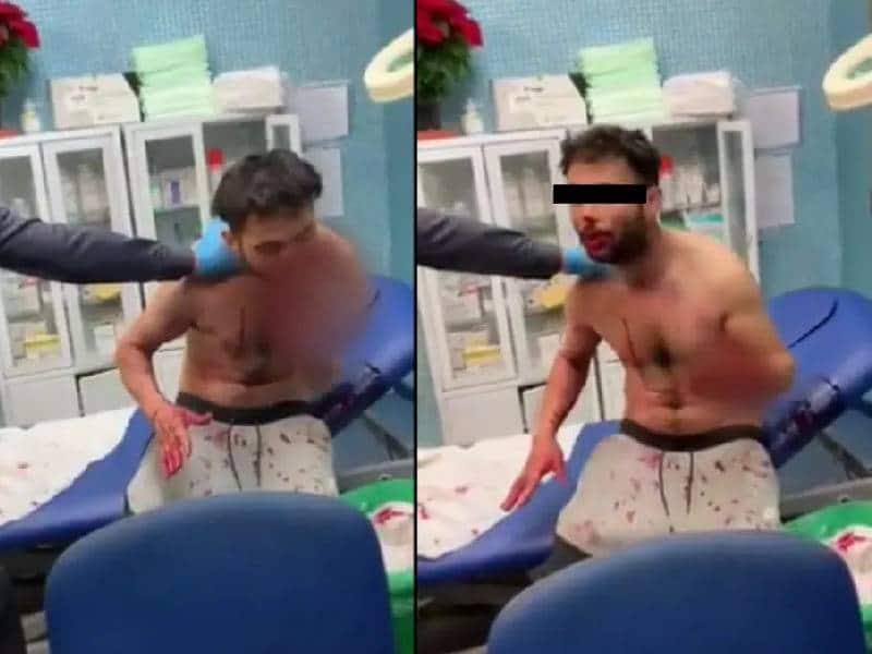 VIDEO: Impactan imágenes de hombre ¡devorándose! tras consumir droga