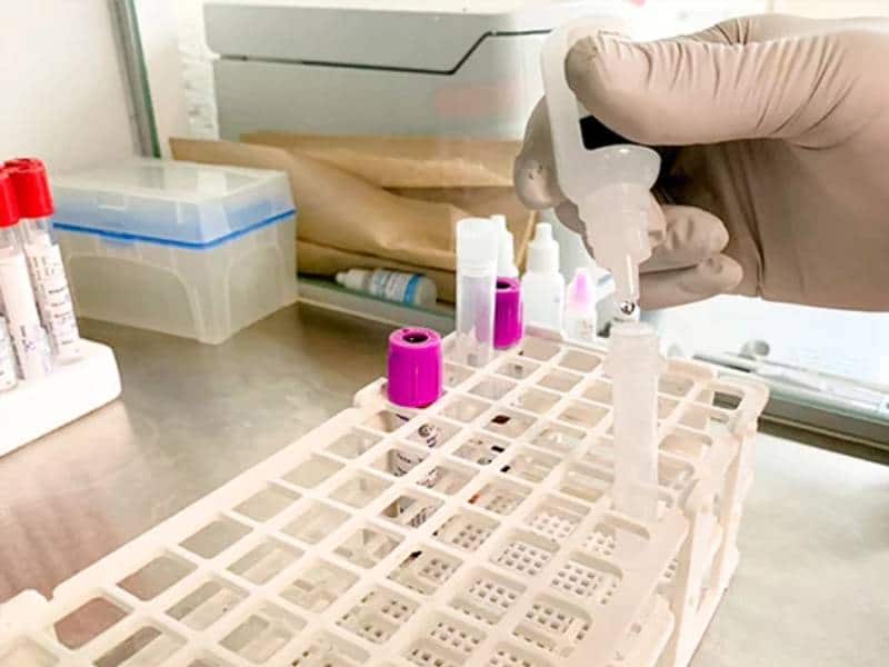 Covid-19, la pandemia que transformó el desarrollo de vacunas