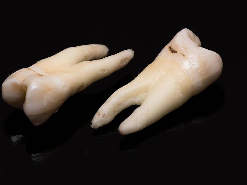 Sujeto repara una tienda y le caen cientos de dientes humanos