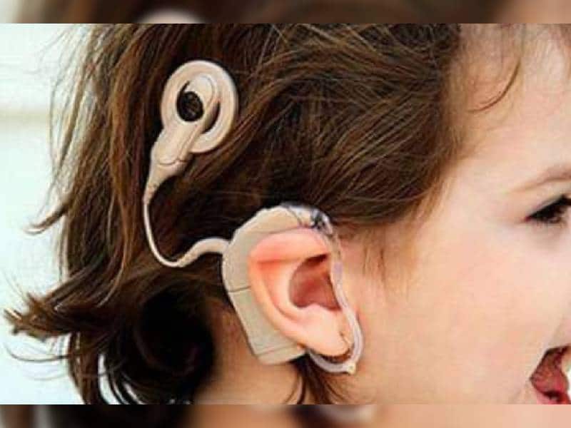 En su día ¿sabes que es un implante coclear?