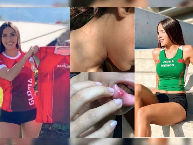 De atleta a influencer por agresiones de su novio