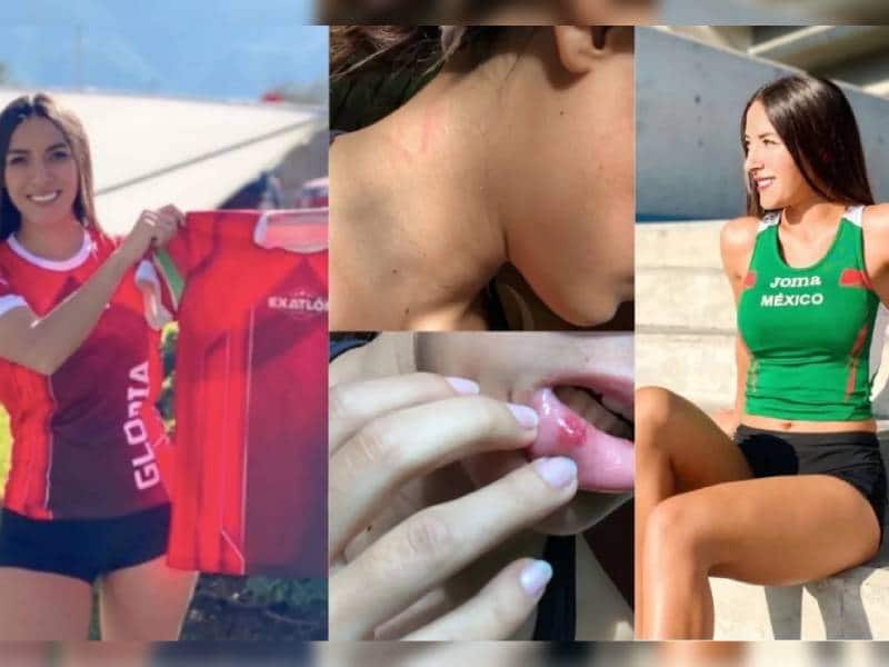 De atleta a influencer, Gloria Murillo, la mujer que denunció en redes a su novio por agresiones