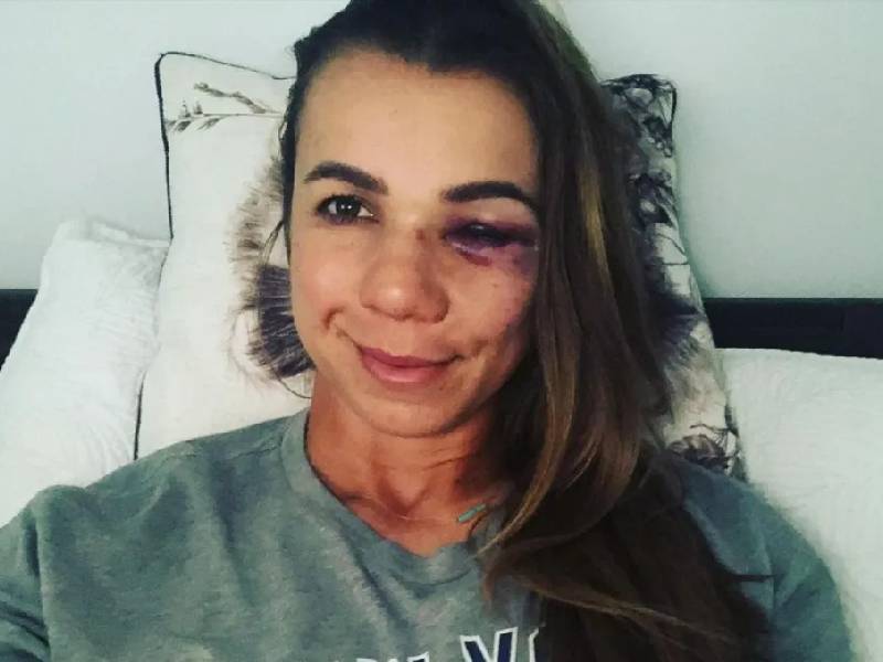 La primer mánager de beisbol pierde su debut por pelotazo en el ojo
