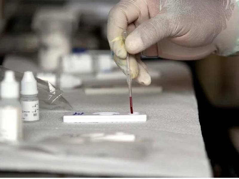 En alerta para tratar de detectar casos de hepatitis