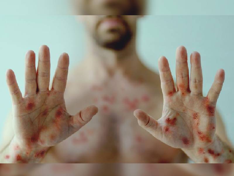La OMS recomienda a hombres gays reducir el número de parejas sexuales