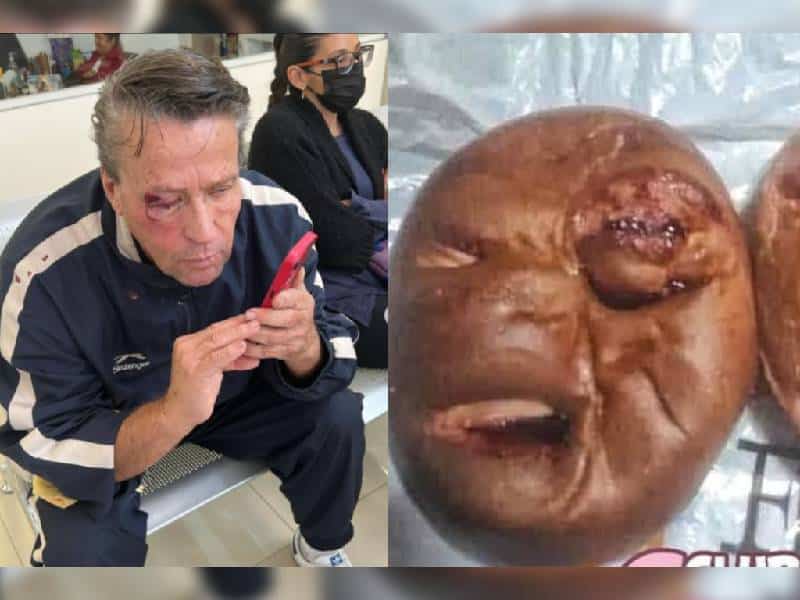 ¿Se te antoja? Sacan pan inspirado en el rostro golpeado de Alfredo Adame