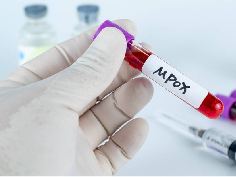 Al alza Mpox en Quintana Roo