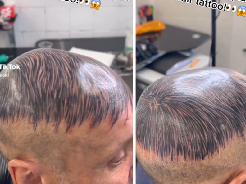 TikTok_ ¿Cambio de look_ Hombre se tatúa cabello para ocultar su calvicie