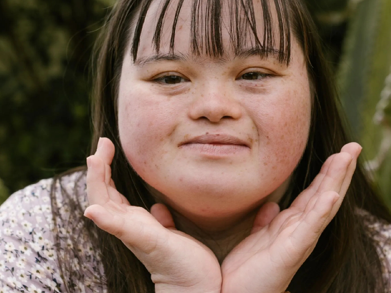 sindrome down