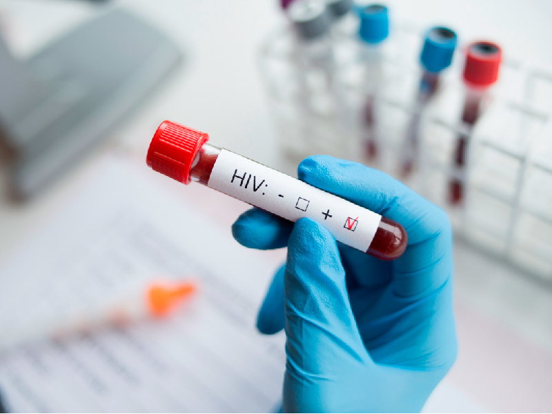 Cofepris aprueba nuevo tratamiento para el VIH