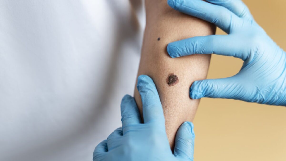 Anuncian campaña de prevención de rickettsiosis.