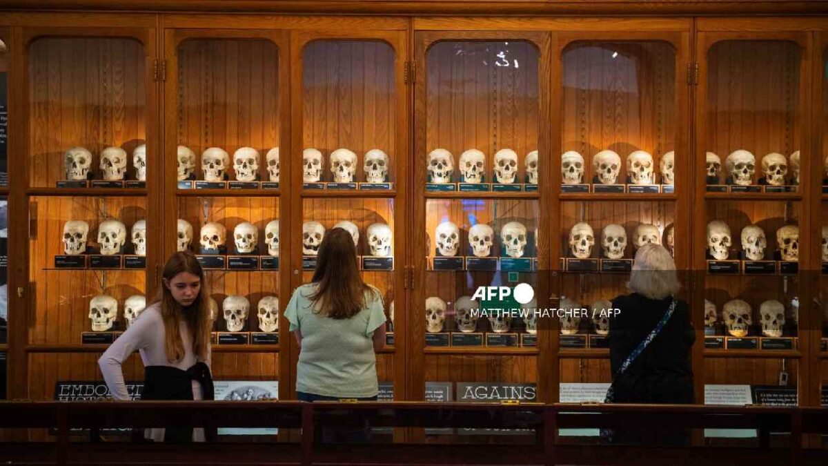 Causa polémica muestra de esqueletos anónimos.
